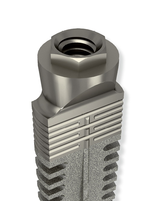 Implantatsystem für die Versorgung schmaler Kieferkämme